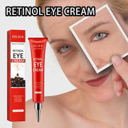 Retinol Firming Eye Cream Moisturizes Around Eyes, Tightens Skin,